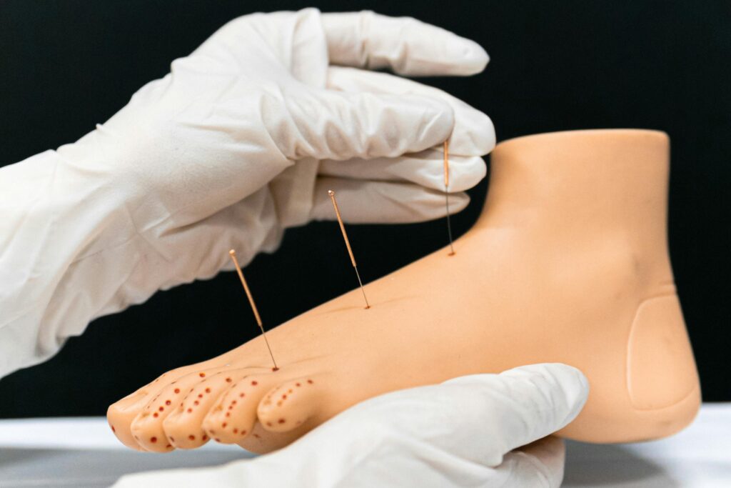 Close-up of a foot model with acupuncture needles inserted, demonstrating alternative therapy.